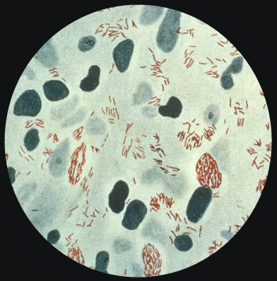 Leprae Bacteria