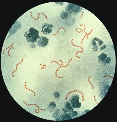 streptococcus  pyogenes